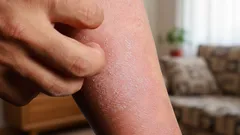 Mikroskooppiset hirviöt lähellä: kuka piileskelee ihosi alla ja miten ne tunnistaa