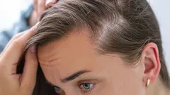 Hiukset lakkaavat kasvamasta – kyse ei ole geeneistä vaan tavoista, joita et edes huomaa